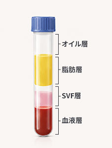 SVF抽出