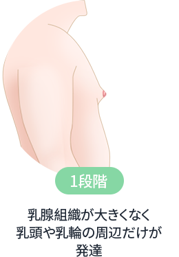 乳腺組織が大きくなく乳頭や乳輪の周辺だけが発達