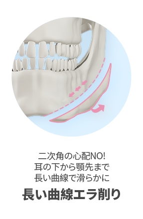 輪郭3点