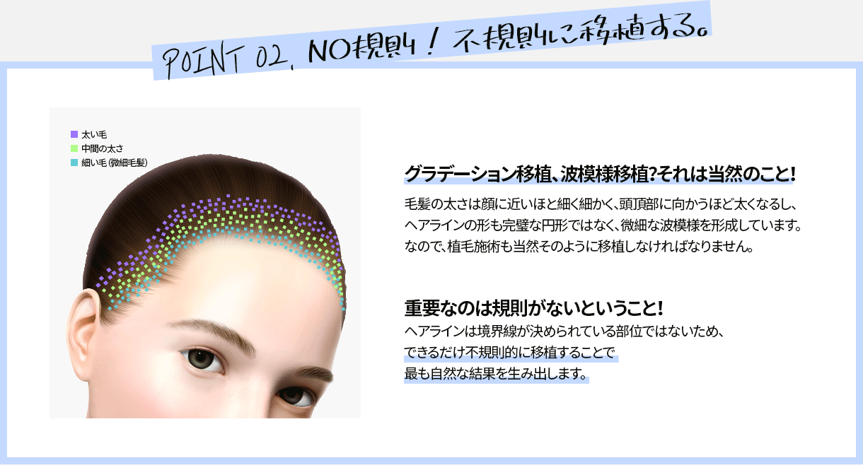 NO規則!不規則に移植する。