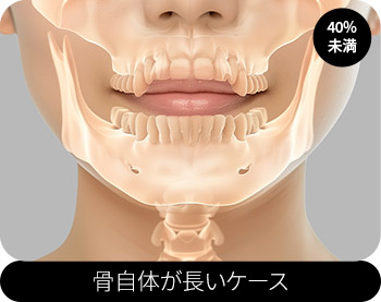 骨自体が長いケース