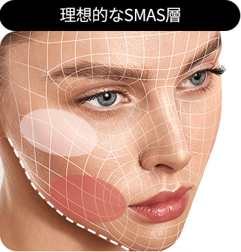 理想的なSMAS層