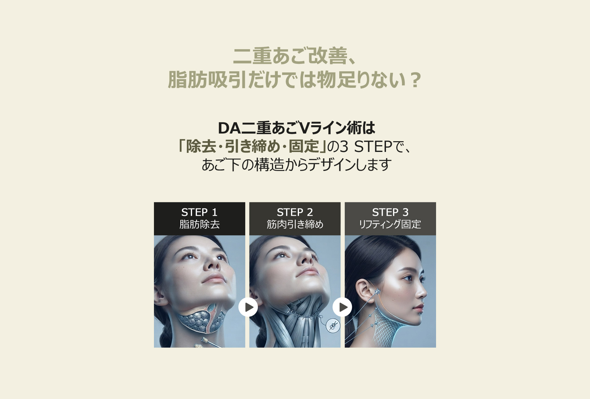 DA二重あごVライン術は除去・引き締め・固定の3 STEPで、あご下の構造からデザインします