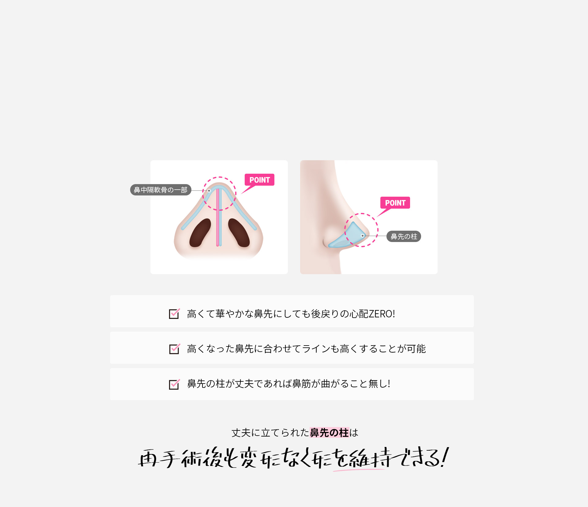 DA2度目の鼻整形