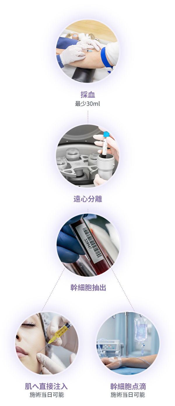 DA血液由来幹細胞の施術プロセス