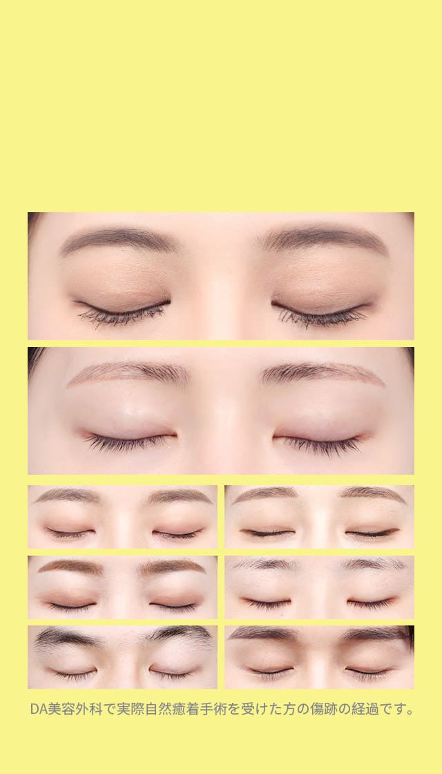 DA華やかなセミアウト