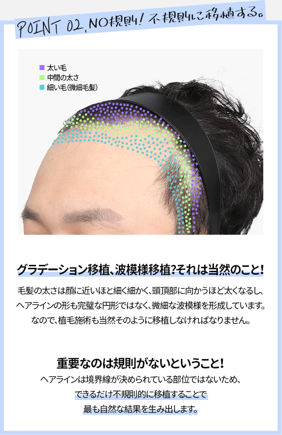 NO規則!不規則に移植する。