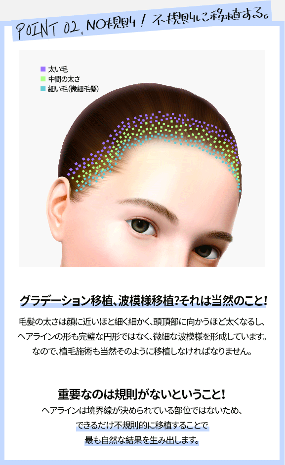 NO規則!不規則に移植する。