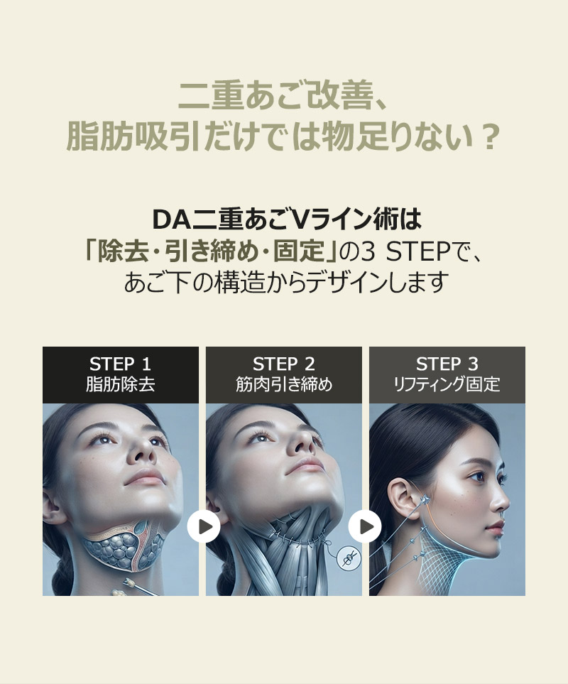 DA二重あごVライン術は除去・引き締め・固定の3 STEPで、あご下の構造からデザインします