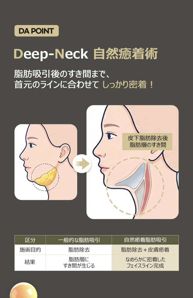 Deep-Neck 自然癒着術、 脂肪吸引後のすき間まで、首元のラインに合わせて しっかり密着！