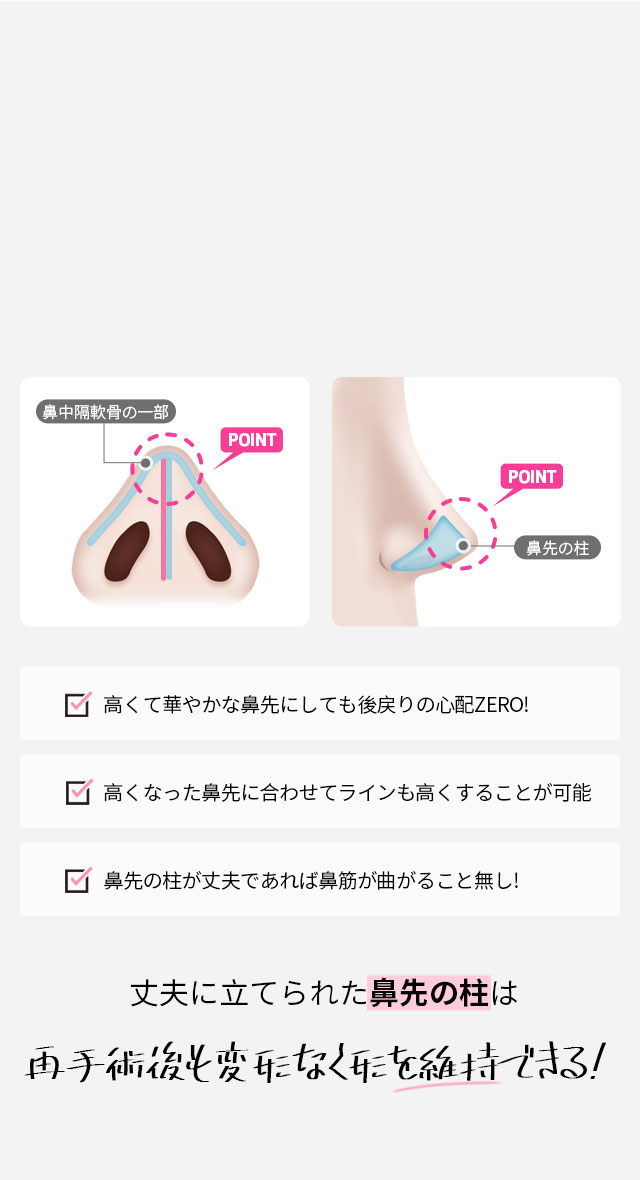 DA2度目の鼻整形