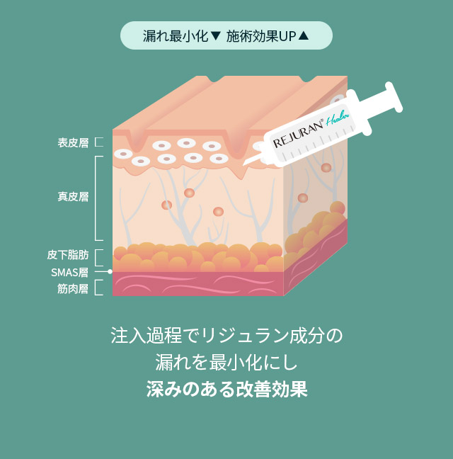 DAリジュランヒーラー