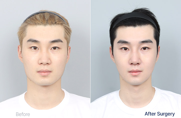 輪郭3点前後写真