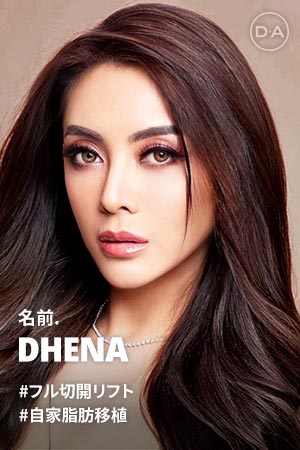 DA モデルストーリー-Dhena
